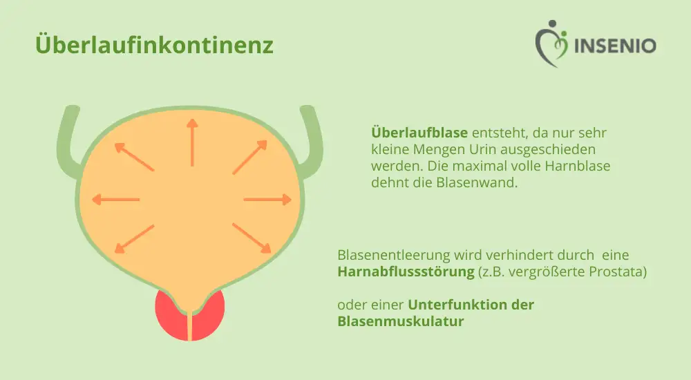Blase Entleert Sich Nicht Vollständig Mann